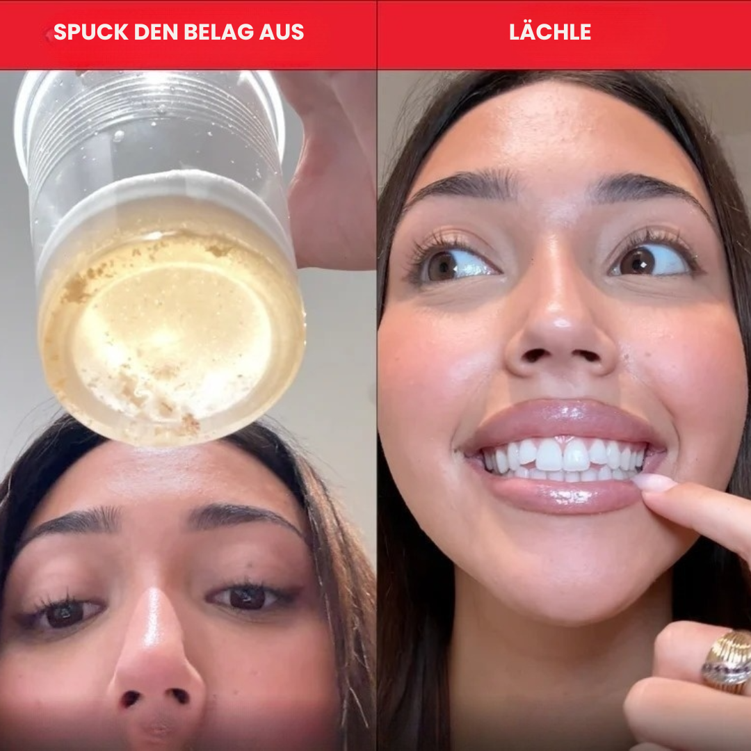 ID Smile - Zahnweiß-Mundwasser